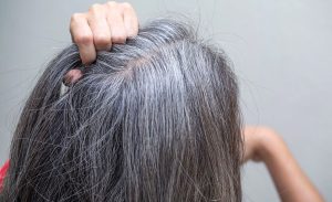 چند اقدام ساده و کاربردی برای جلوگیری و رفع سفیدی مو